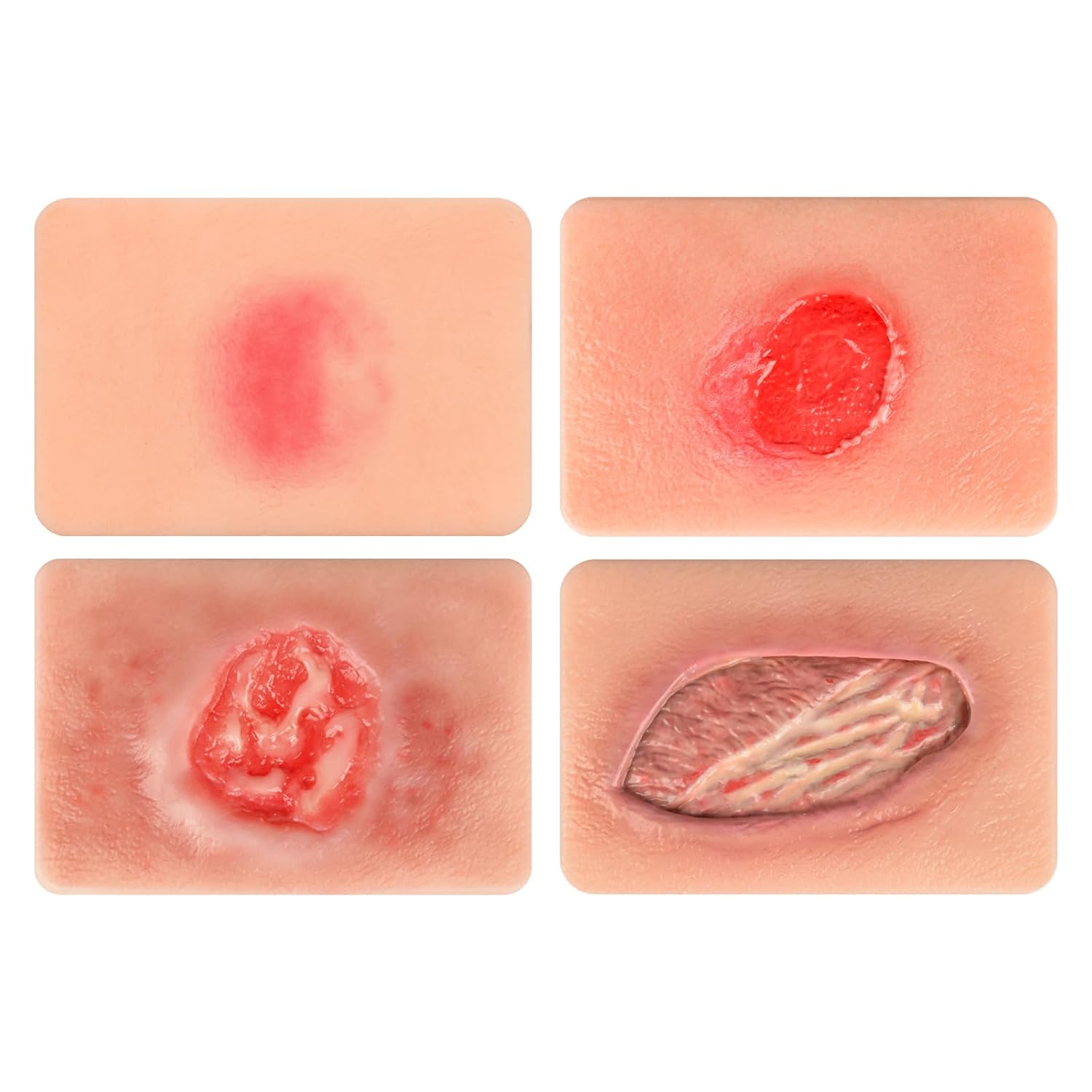 Pressure Ulcer Wound Models Pocket Size for Nursing Training, Pressure Wound Packing Trainer for Medical Education, Bedsore Wound Care Demonstrations Tool