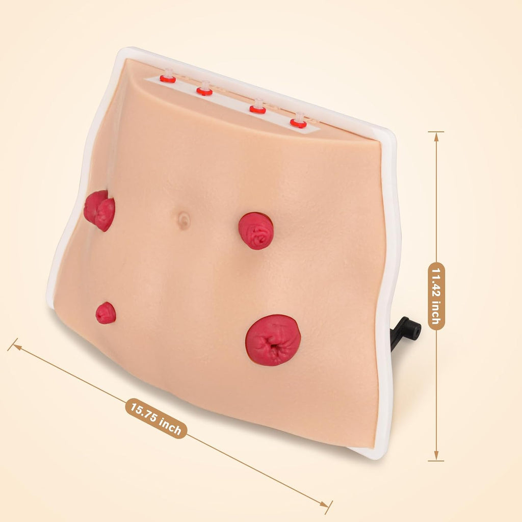 Ostomy Care Trainer Kit, Realistic Abdominal Stoma Model with 4 Stoma Types, Medical Simulation Model for Nursing Students & Patient Care Training