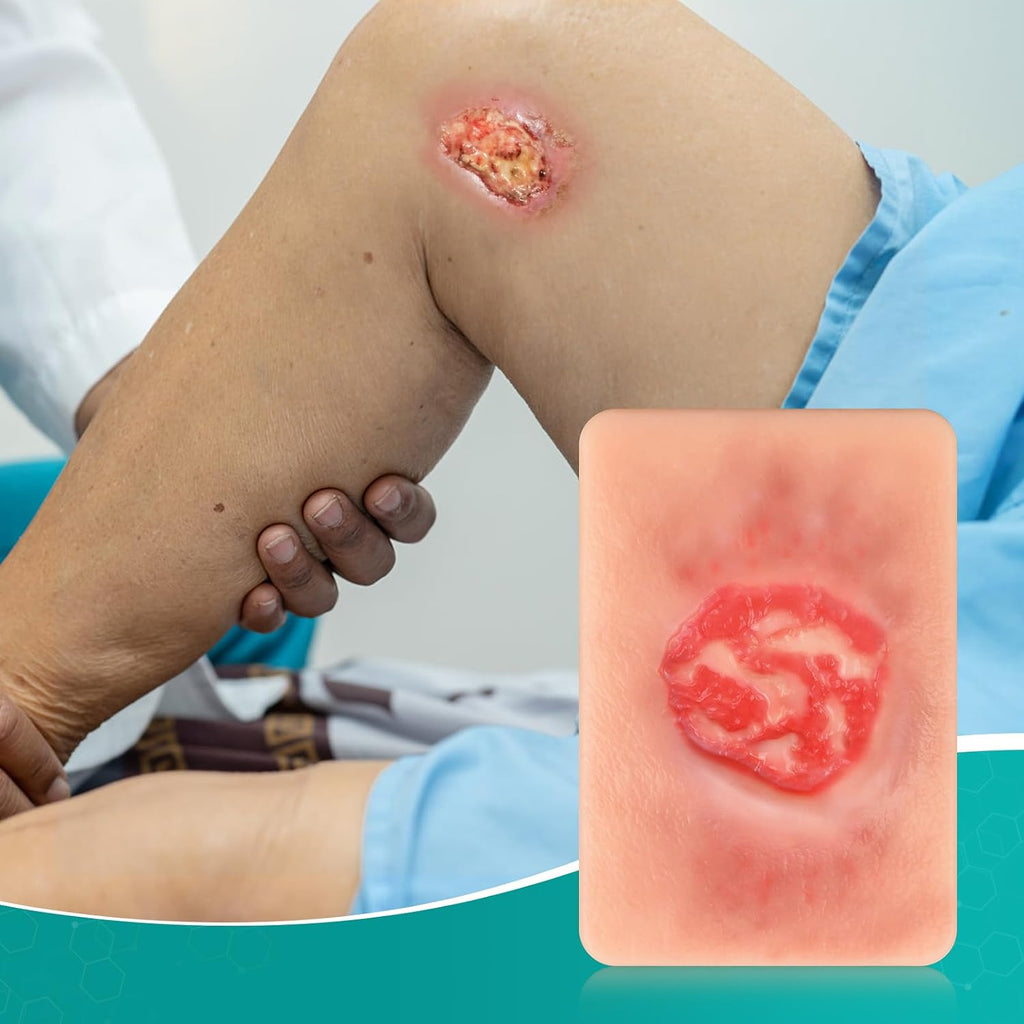 Pressure Ulcer Wound Models Pocket Size for Nursing Training, Pressure Wound Packing Trainer for Medical Education, Bedsore Wound Care Demonstrations Tool