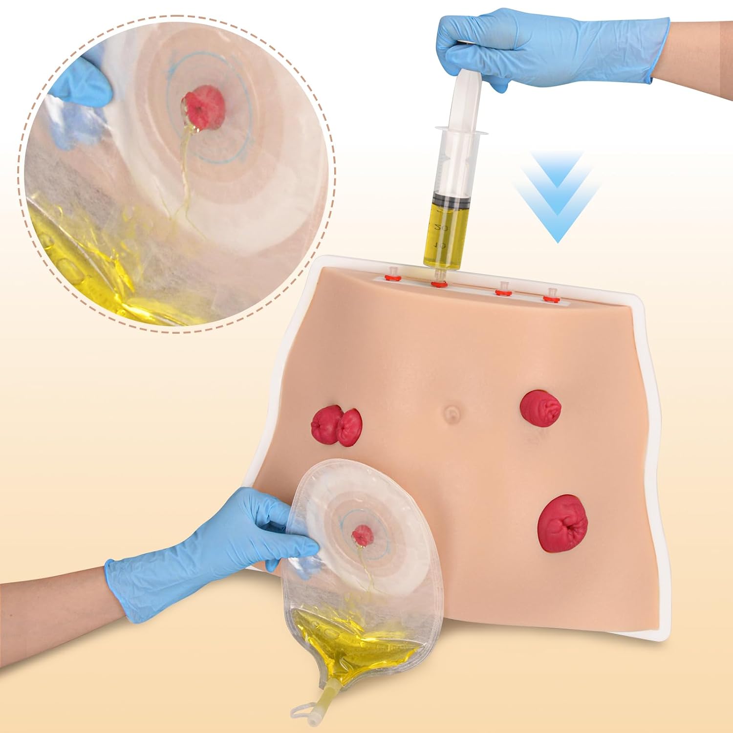 Ostomy Care Trainer Kit, Realistic Abdominal Stoma Model with 4 Stoma Types, Medical Simulation Model for Nursing Students & Patient Care Training
