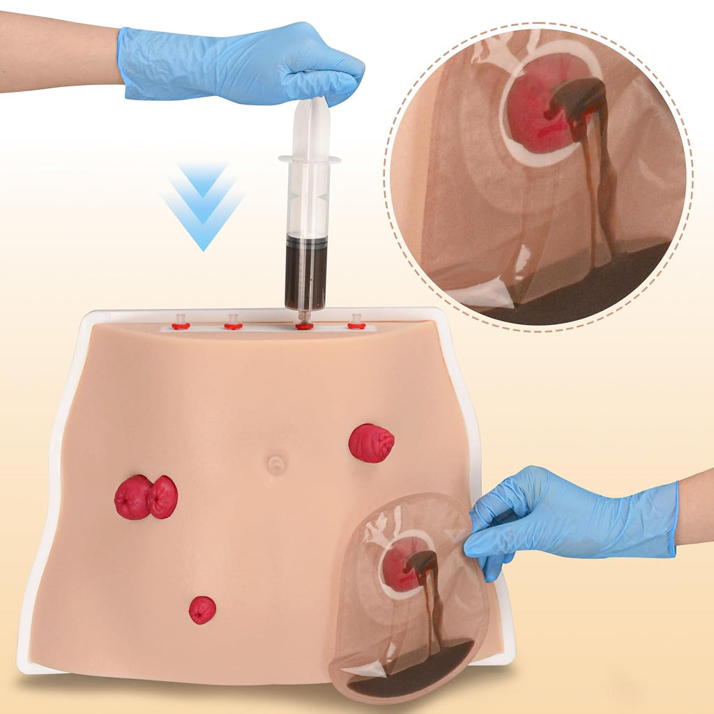 Ostomy Care Trainer Kit, Realistic Abdominal Stoma Model with 4 Stoma Types, Medical Simulation Model for Nursing Students & Patient Care Training