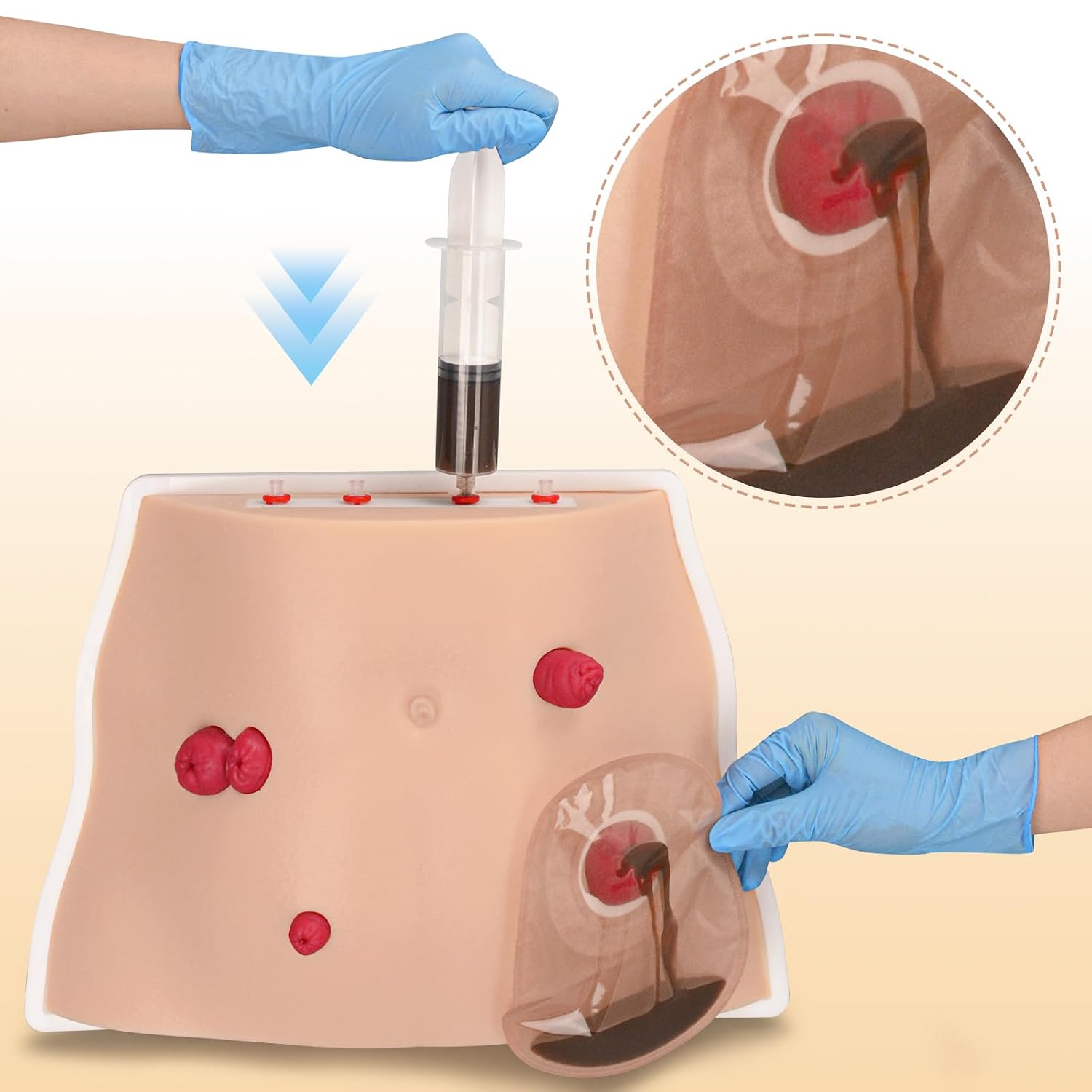 Ostomy Care Trainer Kit, Realistic Abdominal Stoma Model with 4 Stoma Types, Medical Simulation Model for Nursing Students & Patient Care Training