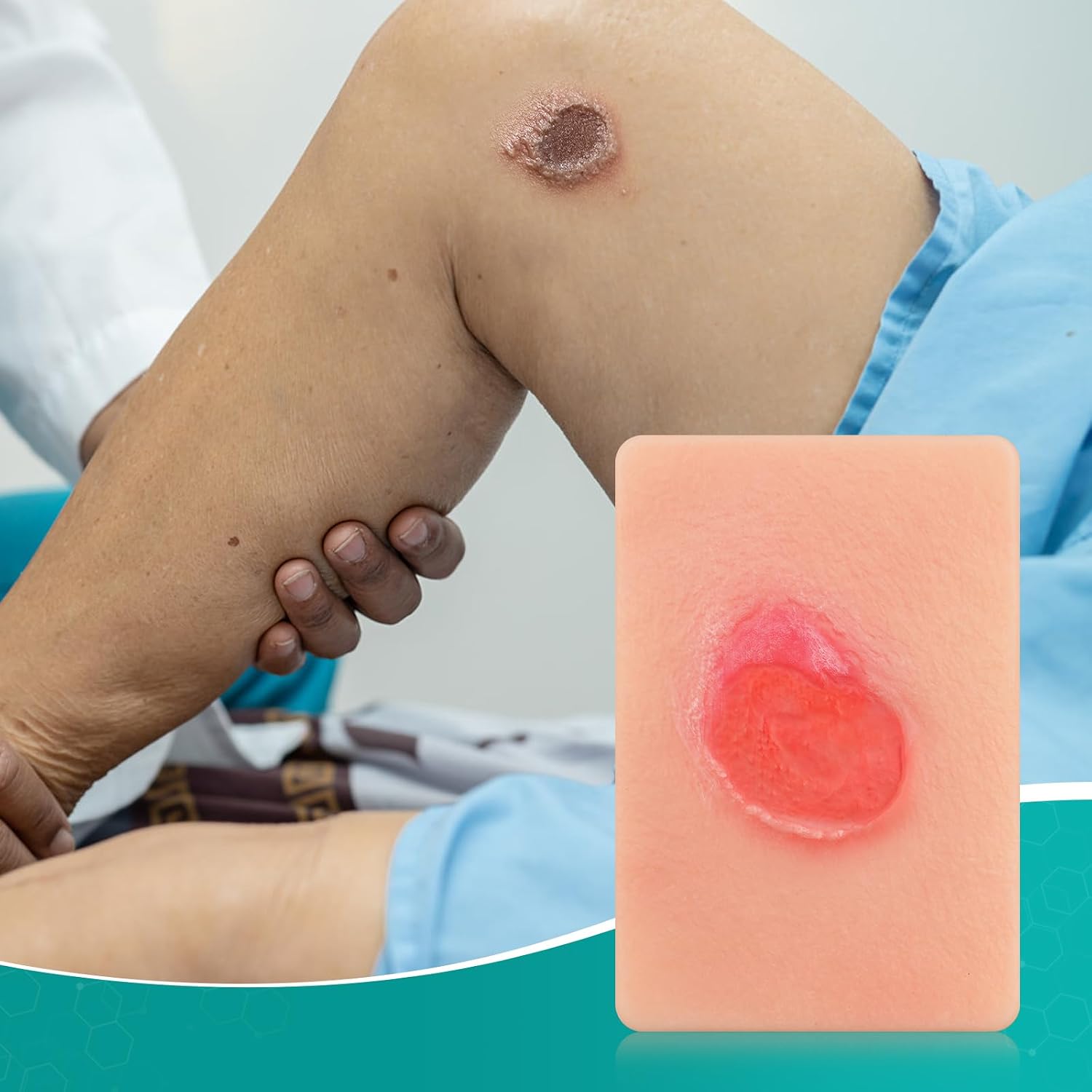 Pressure Ulcer Wound Models Pocket Size for Nursing Training, Pressure Wound Packing Trainer for Medical Education, Bedsore Wound Care Demonstrations Tool