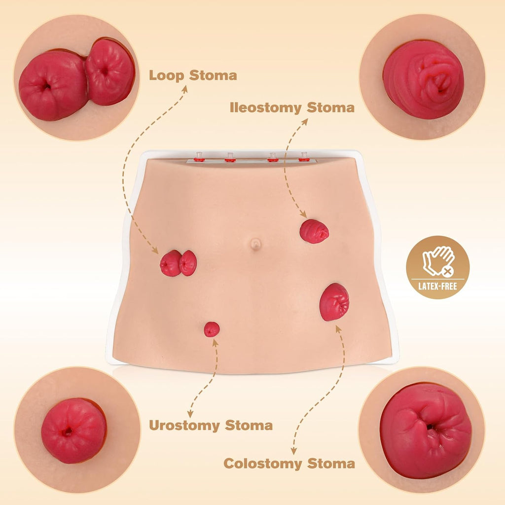 Ostomy Care Trainer Kit, Realistic Abdominal Stoma Model with 4 Stoma Types, Medical Simulation Model for Nursing Students & Patient Care Training