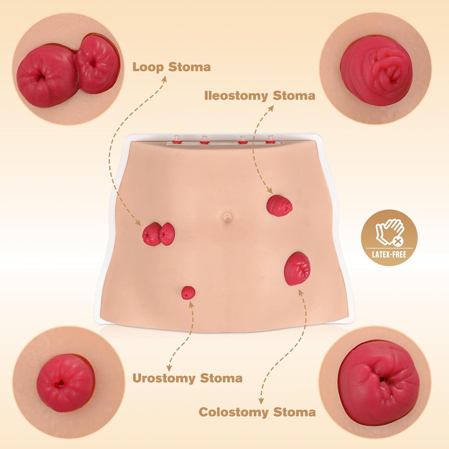 Ostomy Care Trainer Kit, Realistic Abdominal Stoma Model with 4 Stoma Types, Medical Simulation Model for Nursing Students & Patient Care Training