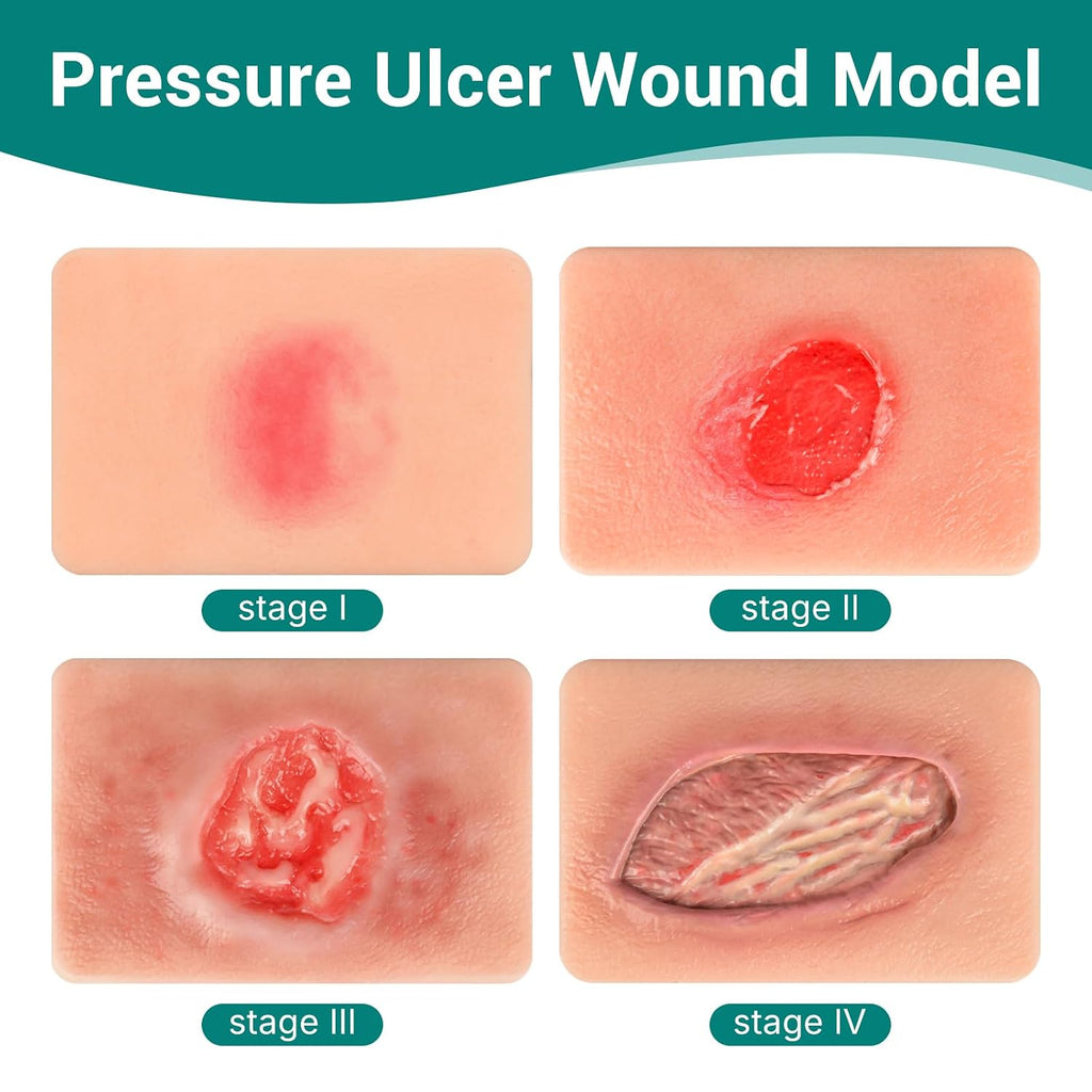 Pressure Ulcer Wound Models Pocket Size for Nursing Training, Pressure Wound Packing Trainer for Medical Education, Bedsore Wound Care Demonstrations Tool