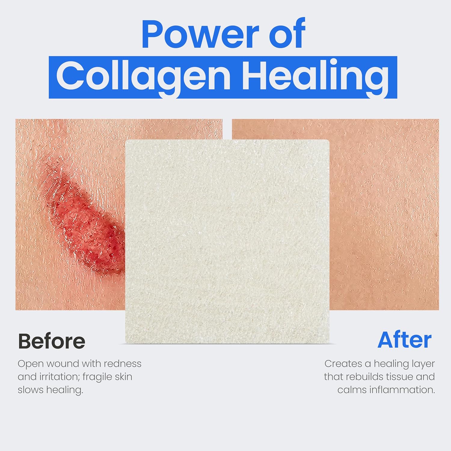 Collagen Dressing Pads - 7 x 7 in 5-Pack Collagen Pads for Wounds - Non-Adherent Collagen Dressing for Wound Care - Safe n' Simple Wound Care Supplies